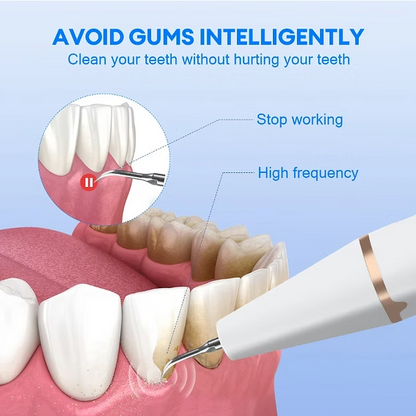 Water Dental Flosser