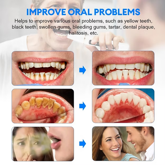 Water Dental Flosser